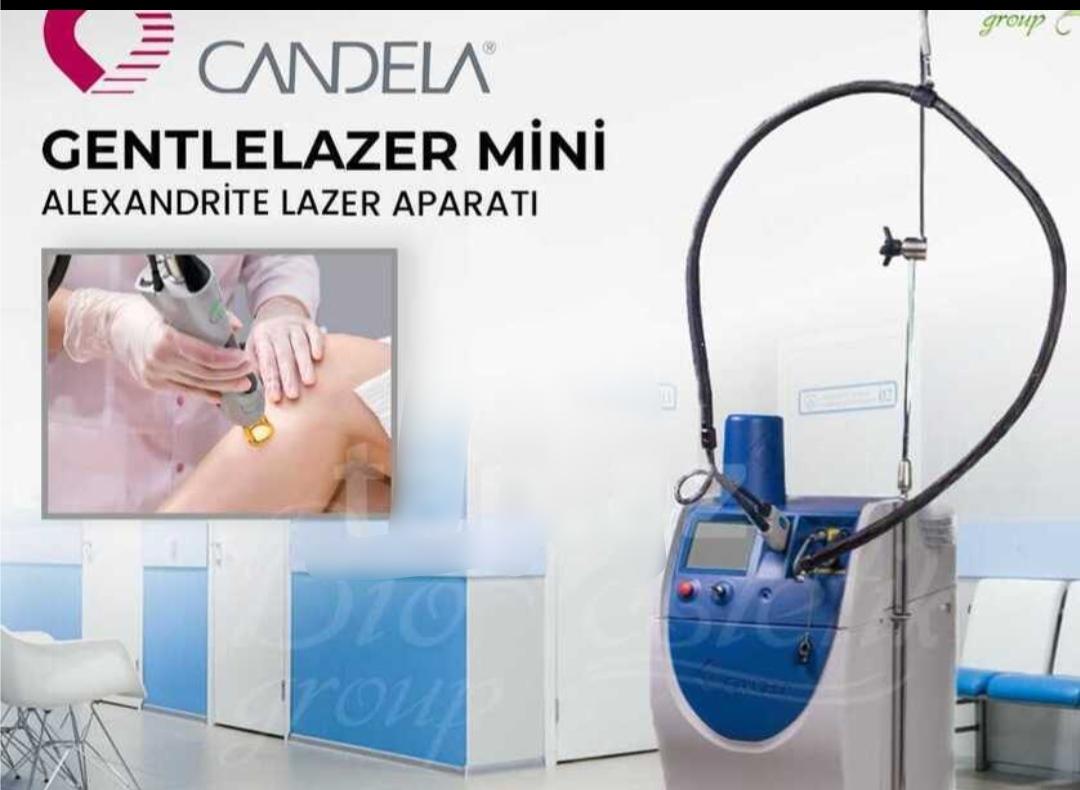 Lazer epilyasiya aparatı "Candella"